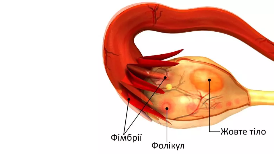 Likuvannya Kisti Zhovtogo Tila Pravogo I Livogo Yayechnika Simptomi Prichini 6801 Min.jpg