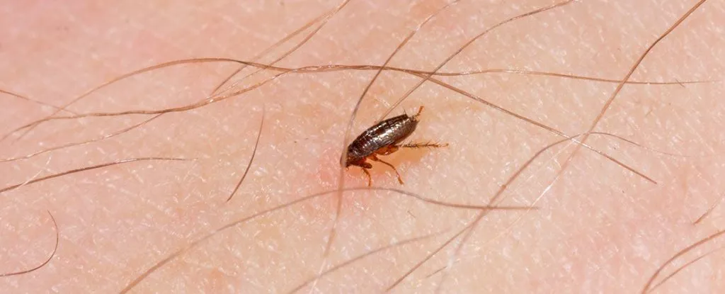 Fleas On Human Skin Closeup