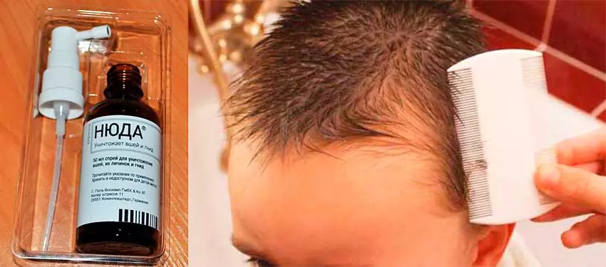 Nyuda Ot Vshej I Gnid Pravilnoe Primenenie