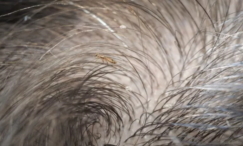 Xyi1ggmroktrsmdgm4dpwzwafgsz1r1rlguokdj3 1200