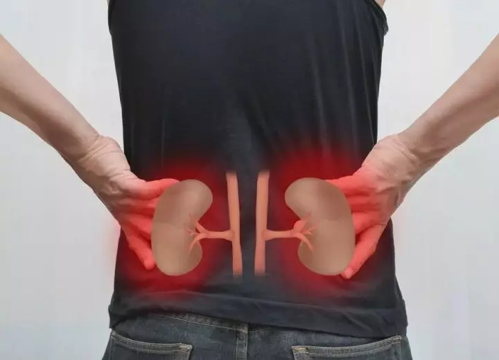 Otpw6pfztibfkui2t3uqgv3kcvn8cd0kbtckkde1 720