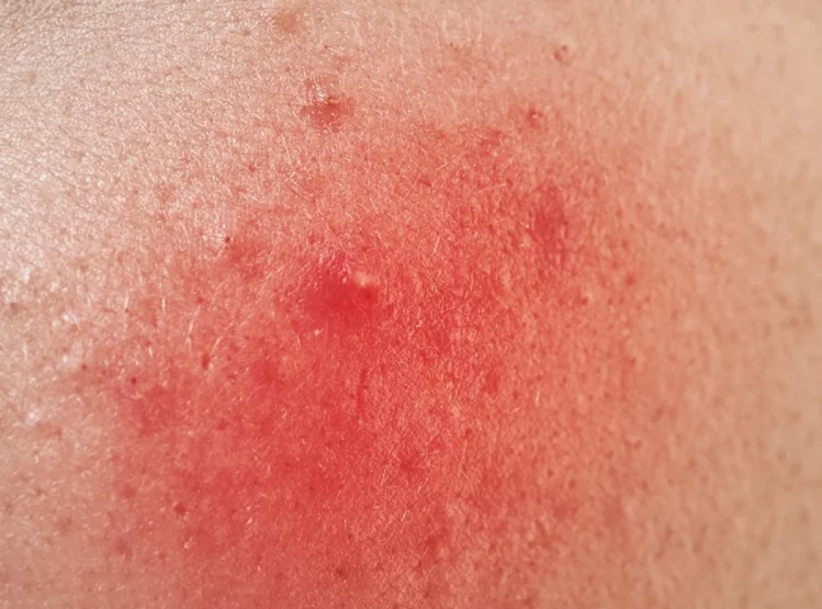 Eqsufotfeqfo6jaezoesbaouhx9srhxbpoktedtq