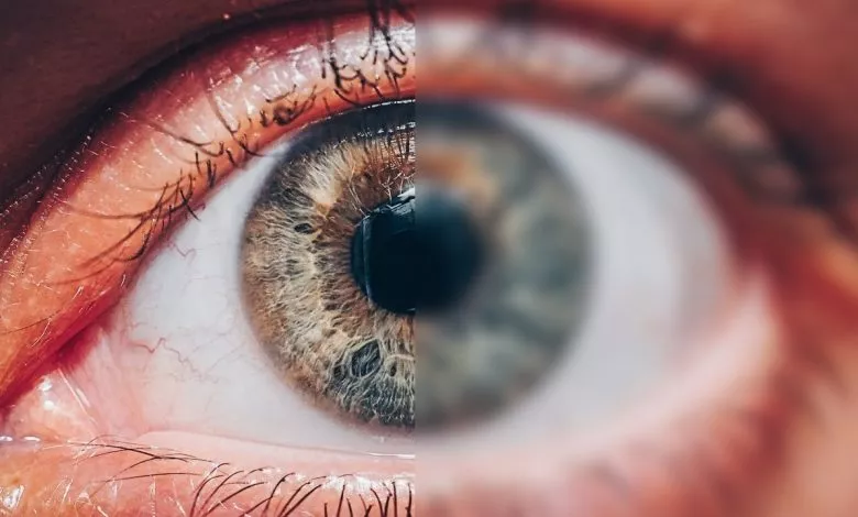 6375200536f8bb804557ea68 Accomodative Dysfunction Adhd